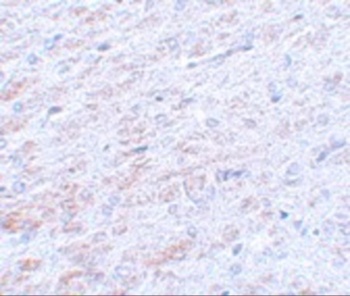 TCF3 Antibody