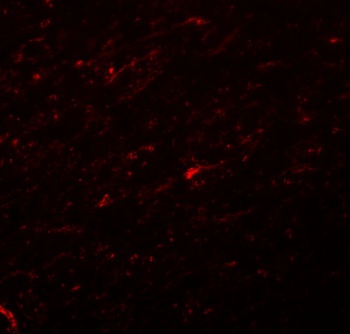 TCF3 Antibody