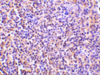 IL27RA Antibody