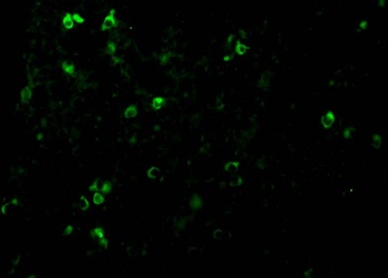 IL27RA Antibody