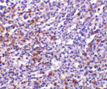 TCCR Antibody