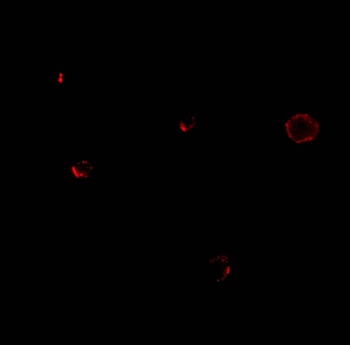 TCCR Antibody