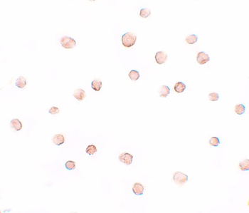 TCC52 Antibody