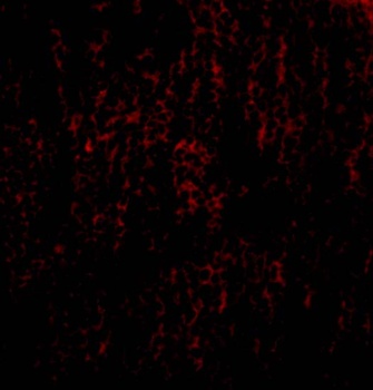 TANK Antibody