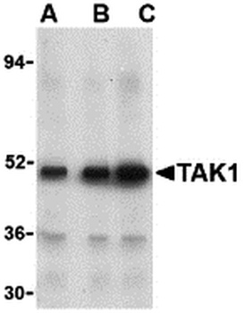 MAP3K7 Antibody