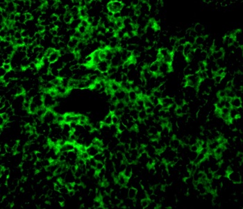 MAP3K7 Antibody