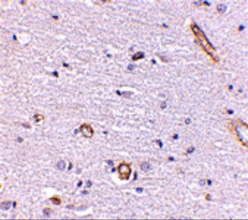 Syntaphilin Antibody