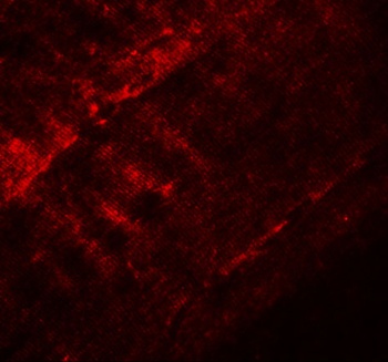 SYNPO2 Antibody