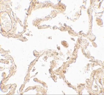 SUZ12 Antibody