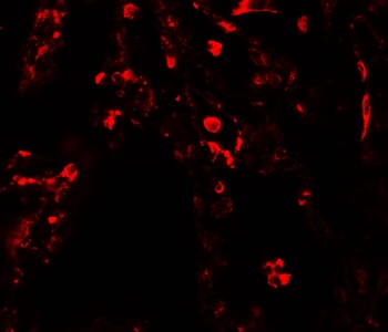 SUZ12 Antibody