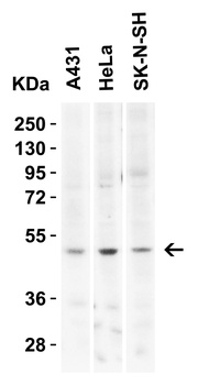 KREMEN2 Antibody