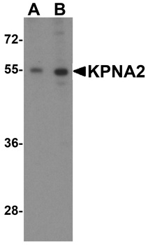 KPNA2 Antibody