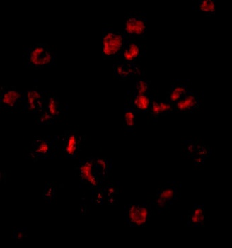 Sumo Antibody
