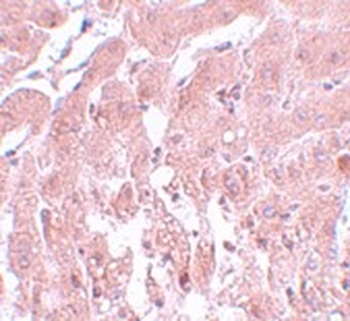 SUMO2/3 Antibody