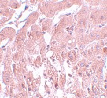 SUMO2 Antibody