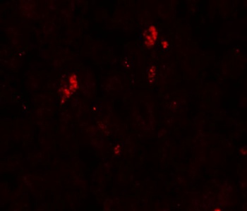 SUMO2/3 Antibody