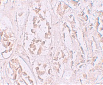 STOX2 Antibody