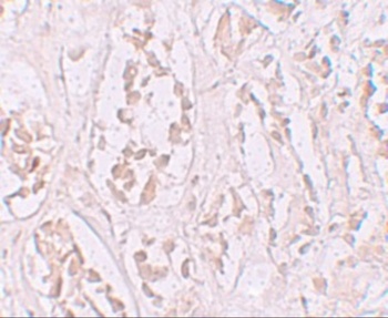 STOX2 Antibody