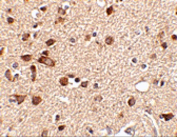Stk39 Antibody