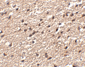 Stk39 Antibody