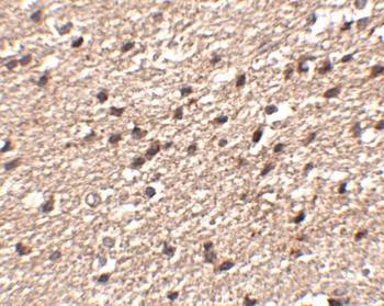 STK39 Antibody