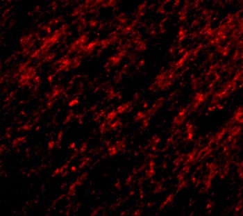Stk39 Antibody