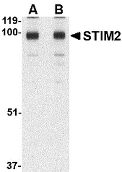 STIM2 Antibody
