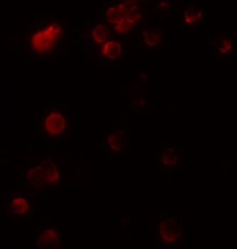 KIR2DS2 Antibody