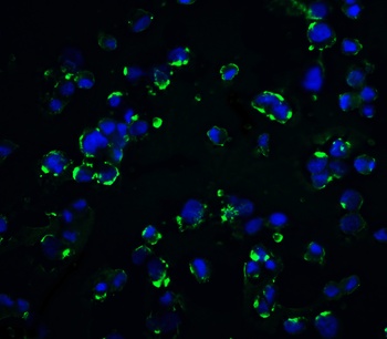 KIR2DS2 Antibody