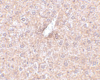 STEAP3 Antibody