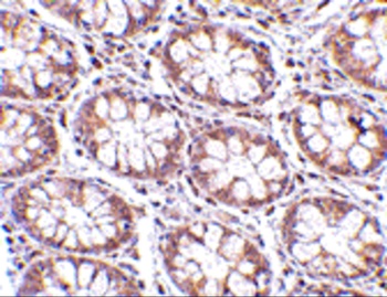 STEAP2 Antibody