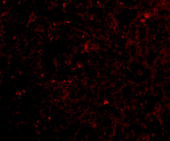 STEAP1 Antibody