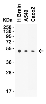 STEAP1 Antibody