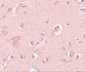 STAU1 Antibody