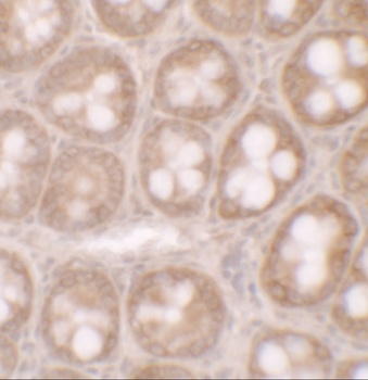 STAT3 Antibody