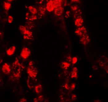 STAT3 Antibody
