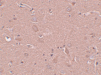 SRPX1 Antibody