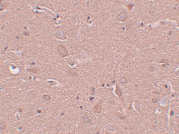 SRPX Antibody