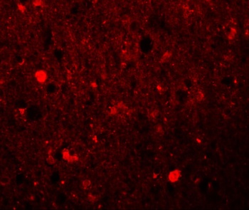 SRPX1 Antibody