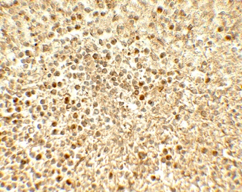 SREBF2 Antibody