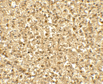 SREBF1 Antibody