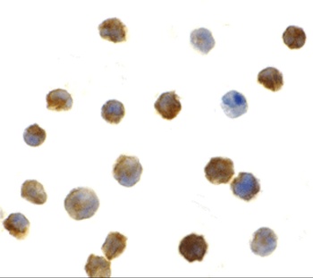 IRAK2 Antibody