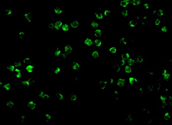 IRAK2 Antibody