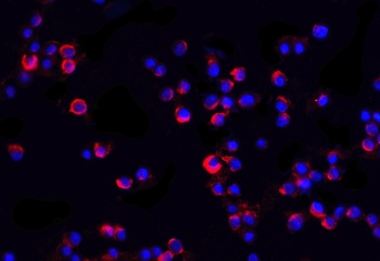IRAK2 Antibody