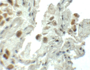 SPT1 Antibody