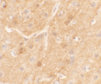 TRIM51 Antibody