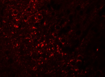 TRIM51 Antibody