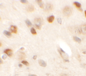SPRYD2 Antibody