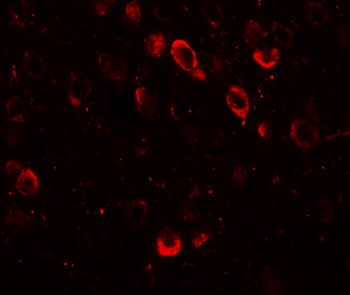 SPRYD2 Antibody