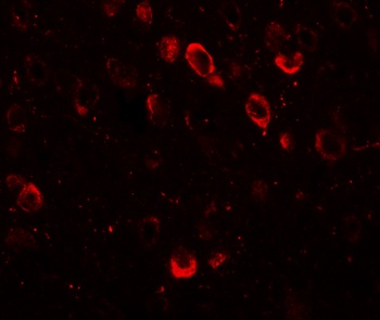 CMYA5 Antibody